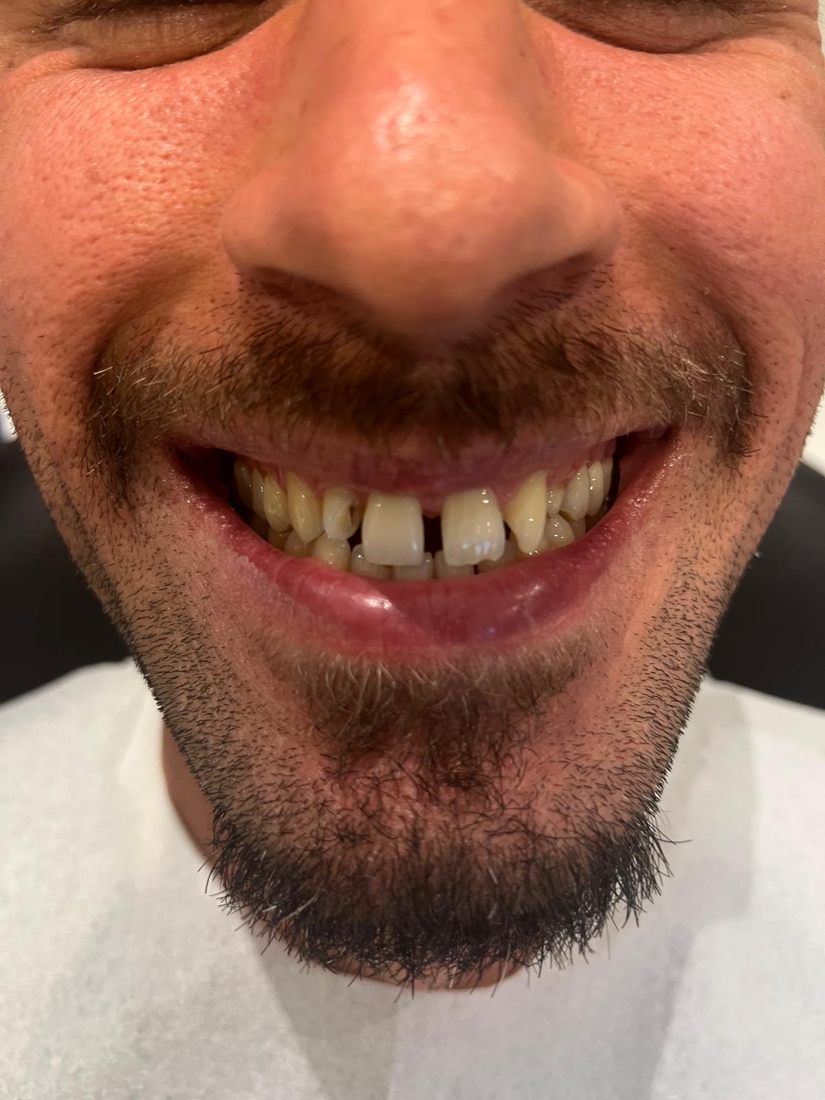 ECE Dental Patient Transformation